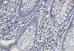 CLSTN1 Antibody in Immunohistochemistry (Paraffin) (IHC (P))