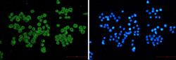 CLIP1 Antibody in Immunocytochemistry (ICC/IF)