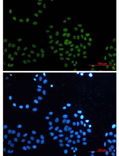 CDK9 Antibody in Immunocytochemistry (ICC/IF)