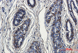 CD99 Antibody in Immunohistochemistry (Paraffin) (IHC (P))