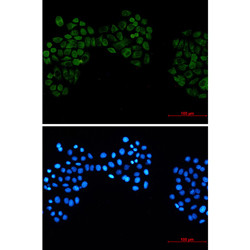 CSNK2B Antibody in Immunocytochemistry (ICC/IF)
