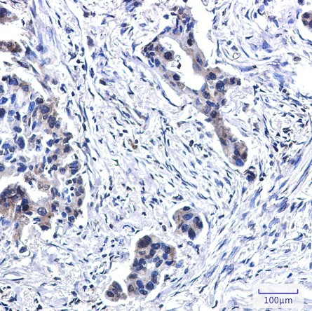 BUB1B Antibody in Immunohistochemistry (Paraffin) (IHC (P))
