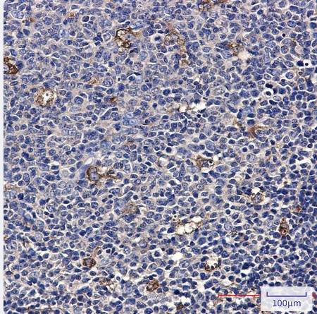 ATP6V1A Antibody in Immunohistochemistry (Paraffin) (IHC (P))