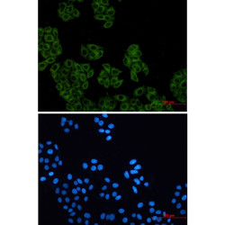 ACTR2 Antibody in Immunocytochemistry (ICC/IF)