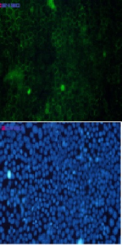 CTTN Antibody in Immunocytochemistry (ICC/IF)
