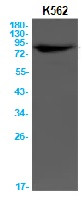 PARP1 Antibody in Western Blot (WB)