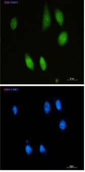 CHAT Antibody in Immunocytochemistry (ICC/IF)