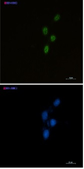 CHEK2 Antibody in Immunocytochemistry (ICC/IF)