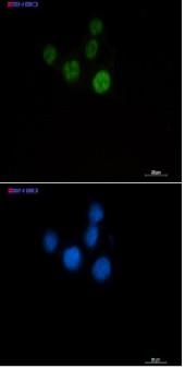CHEK2 Antibody in Immunocytochemistry (ICC/IF)