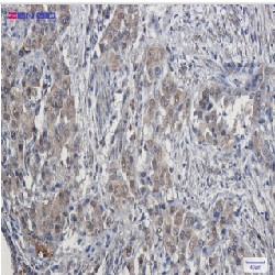 CDK4 Antibody in Immunohistochemistry (Paraffin) (IHC (P))