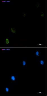 CBL Antibody in Immunocytochemistry (ICC/IF)