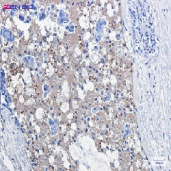 CAT Antibody in Immunohistochemistry (Paraffin) (IHC (P))