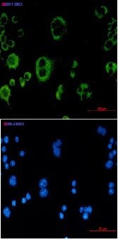 Cat Antibody in Immunocytochemistry (ICC/IF)