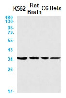 CSNK1A1 Antibody in Western Blot (WB)