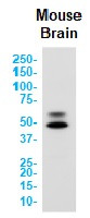 CAMK2B Antibody in Western Blot (WB)