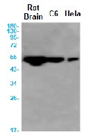 CAMK2D Antibody in Western Blot (WB)