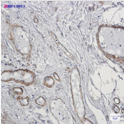 CALD1 Antibody in Immunohistochemistry (Paraffin) (IHC (P))