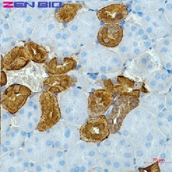 Calb1 Antibody in Immunohistochemistry (Paraffin) (IHC (P))