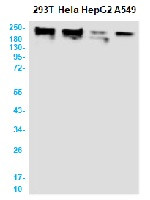 Smarca4 Antibody in Western Blot (WB)