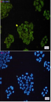 BRAT1 Antibody in Immunocytochemistry (ICC/IF)