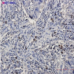 BNIP3L Antibody in Immunohistochemistry (Paraffin) (IHC (P))