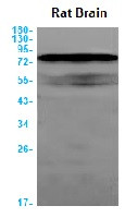 BIN1 Antibody in Western Blot (WB)