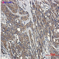 TUBB Antibody in Immunohistochemistry (Paraffin) (IHC (P))