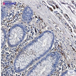 TUBB3 Antibody in Immunohistochemistry (Paraffin) (IHC (P))