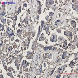 TUBB3 Antibody in Immunohistochemistry (Paraffin) (IHC (P))