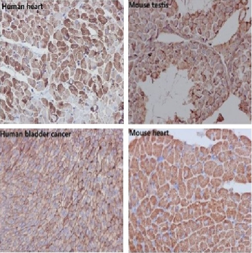 ACTB Antibody in Immunohistochemistry (Paraffin) (IHC (P))