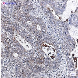 BCL2L1 Antibody in Immunohistochemistry (Paraffin) (IHC (P))