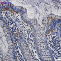 BAK1 Antibody in Immunohistochemistry (Paraffin) (IHC (P))