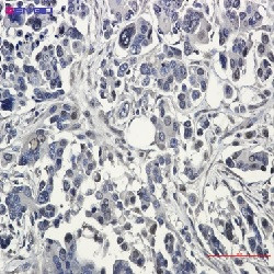 BAG1 Antibody in Immunohistochemistry (Paraffin) (IHC (P))