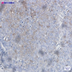 BAD Antibody in Immunohistochemistry (Paraffin) (IHC (P))