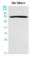 BACE1 Antibody in Western Blot (WB)