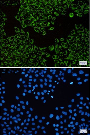 ATP5F1B Antibody in Immunocytochemistry (ICC/IF)