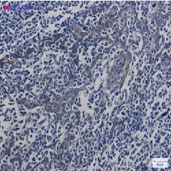 ATP5MC1 Antibody in Immunohistochemistry (Paraffin) (IHC (P))