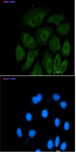 ACLY Antibody in Immunocytochemistry (ICC/IF)
