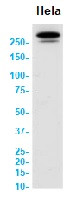 ATM Antibody in Western Blot (WB)