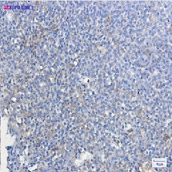 ATG3 Antibody in Immunohistochemistry (Paraffin) (IHC (P))