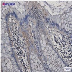GOT1 Antibody in Immunohistochemistry (Paraffin) (IHC (P))