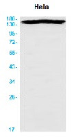 MAP3K5 Antibody in Western Blot (WB)