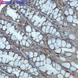ACTR3 Antibody in Immunohistochemistry (Paraffin) (IHC (P))
