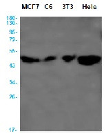 CYP19A1 Antibody in Western Blot (WB)