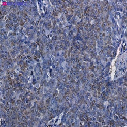 AQP1 Antibody in Immunohistochemistry (Paraffin) (IHC (P))