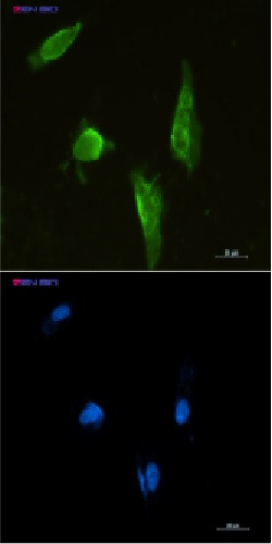 APTX Antibody in Immunocytochemistry (ICC/IF)