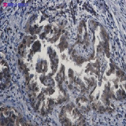 APPL1 Antibody in Immunohistochemistry (Paraffin) (IHC (P))