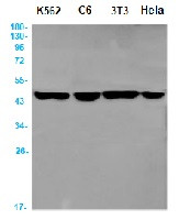 AP3M1 Antibody in Western Blot (WB)