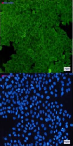 ANXA2 Antibody in Immunocytochemistry (ICC/IF)