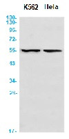 ANGPTL4 Antibody in Western Blot (WB)